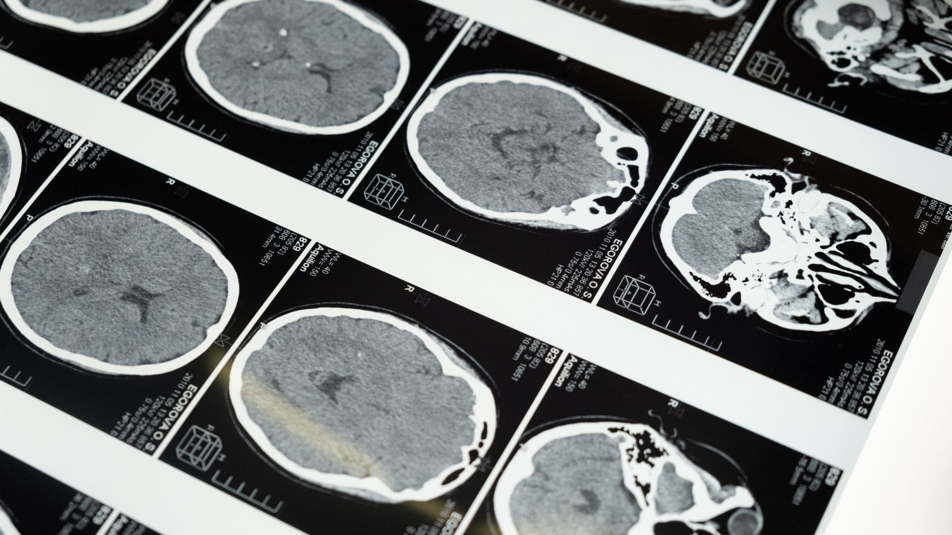 neuromarketing-cos-e-ekeria